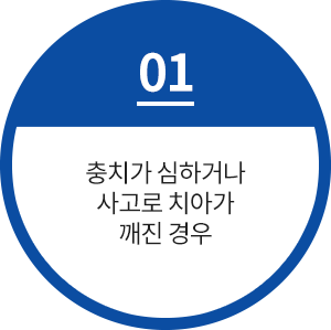 충치가 심하거나 사고로 치아가 깨진 경우