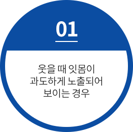 웃을 때 잇몸이 과도하게 노출되어 보이는 경우