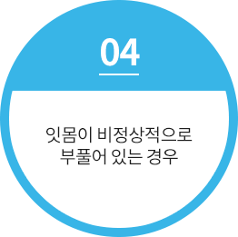 불규칙적인 치열로 인한 잇몸 비대칭이 있을 경우